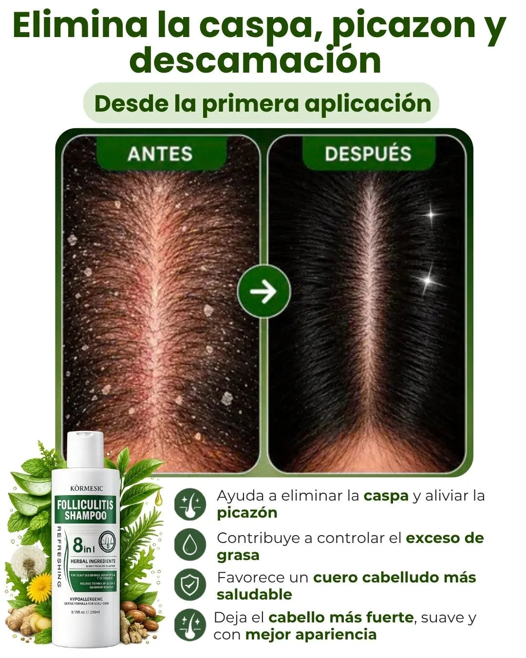 SHAMPOO 8 EN 1 - ELIMINA CASPA E HIDRATA