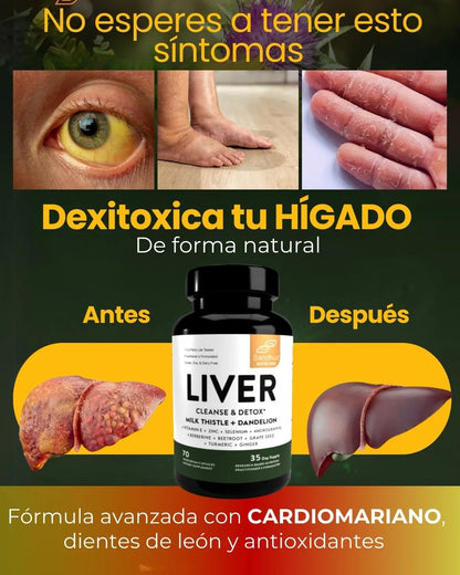 LIVER DETOX PLANTILLA 2