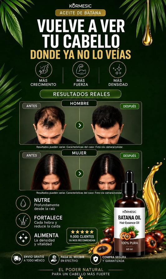ACEITE BATANAS KORMESIC - CREMIENTO CAPILAR