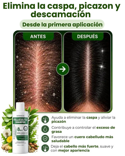 SHAMPOO 8 EN 1 - ELIMINA CASPA E HIDRATA