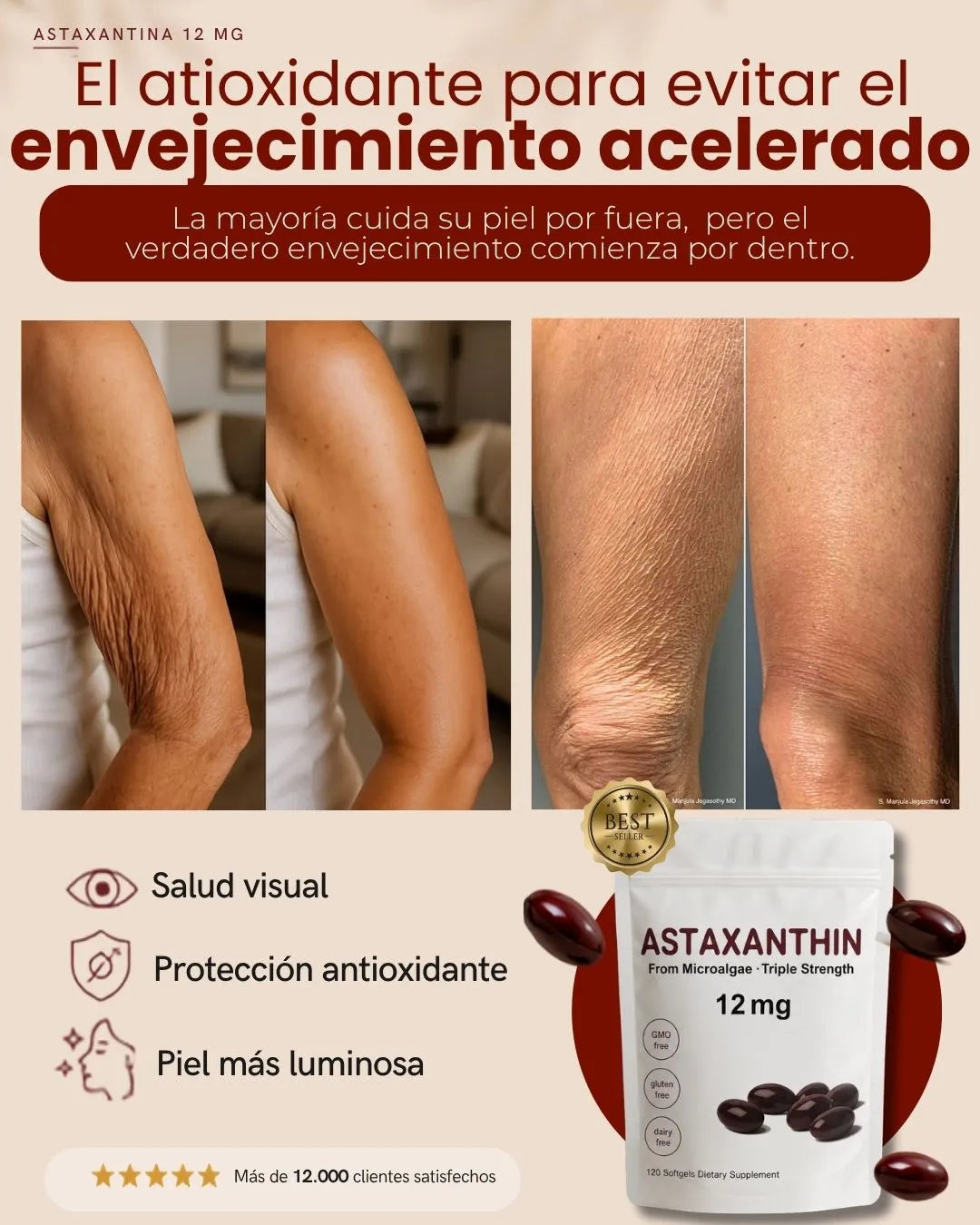 ASTAXANTHIN -  EL ANTIOXIDANTE MÁS PODEROSO