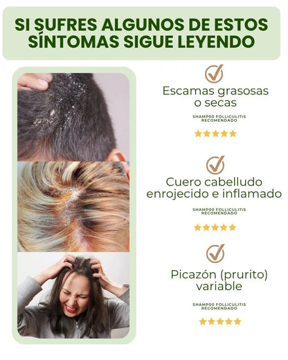 SHAMPOO 8 EN 1 - ELIMINA CASPA E HIDRATA