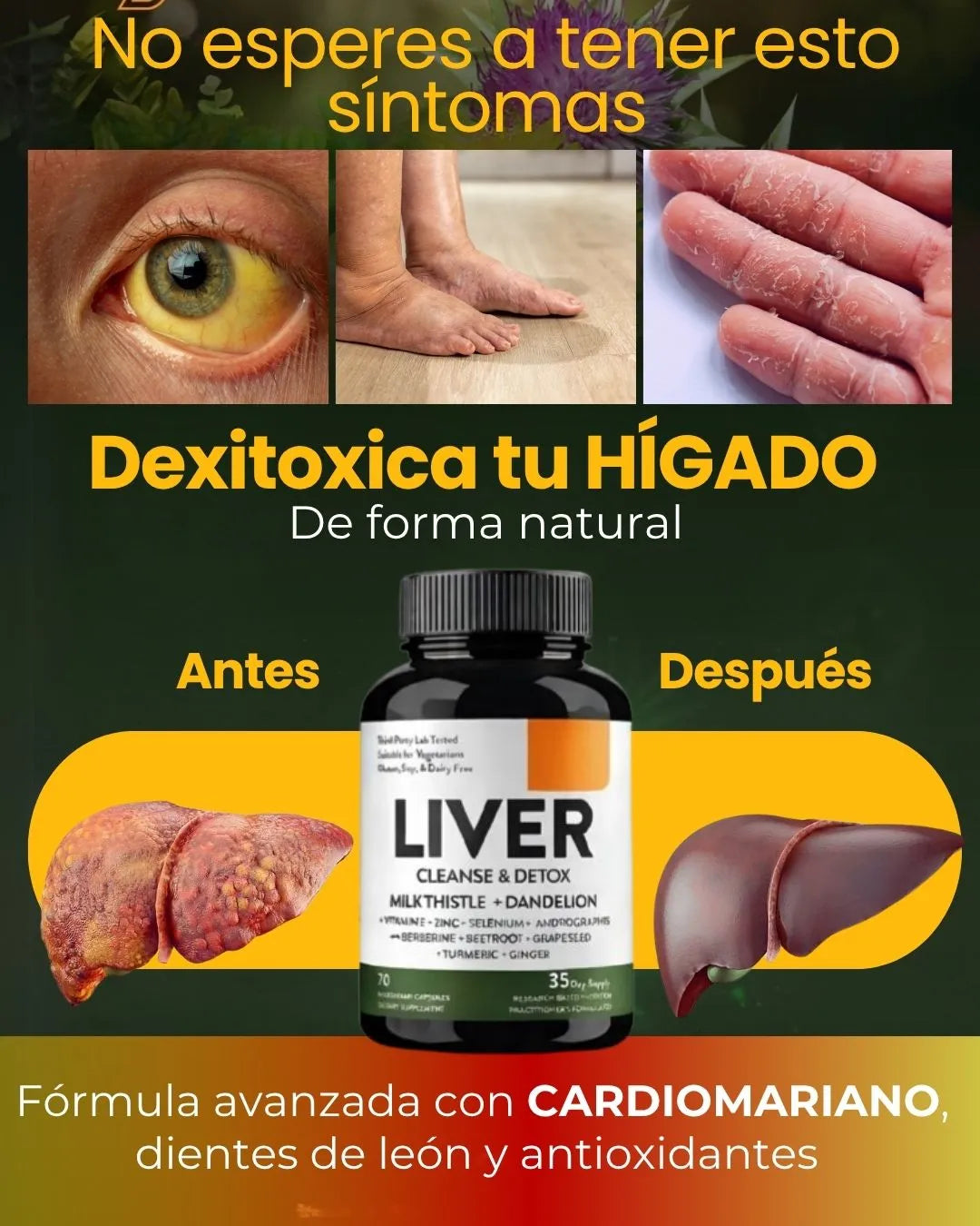 LIVER DETOX PLANTILLA 2