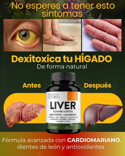 LIVER DETOX PLANTILLA 2