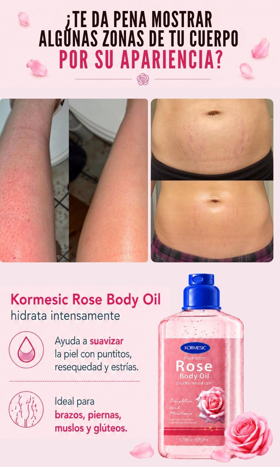 KORMESIC - ACEITE UTRAHIDRATANTE