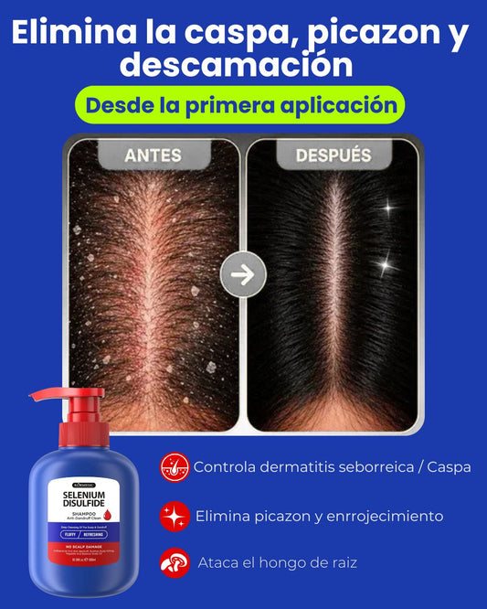 SHAMPOO CONTROL DE CASPA - SELENIUM