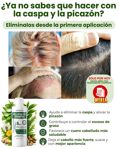 SHAMPOO 8 EN 1 - ELIMINA CASPA E HIDRATA