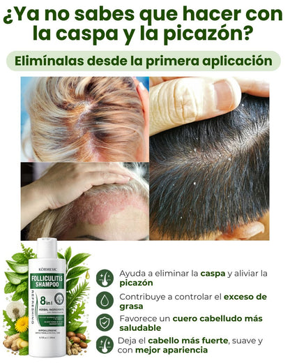 SHAMPOO 8 EN 1 - ELIMINA CASPA E HIDRATA